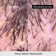 L’Oréal Professionnel Scalp Advanced Anti-discomfort Dermo Regulator shampoo 300 ml – šampón na upokojenie citlivej pokožky hlavy