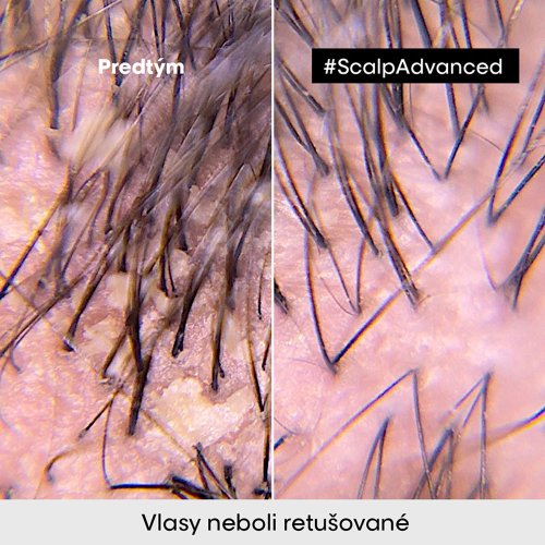 L’Oréal Professionnel Scalp Advanced Anti-discomfort Dermo Regulator shampoo 300 ml – šampón na upokojenie citlivej pokožky hlavy